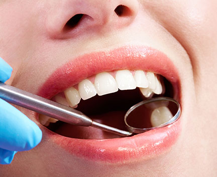 Treatment - Harley Private Dental